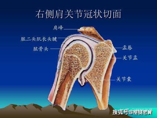 肩关节上盂唇损伤(superior labrum anterior and posterior,slap)在