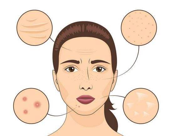 e952d146dc0f46f090486f667b436fdf.jpeg