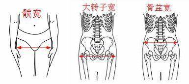 大转子宽:指的是大腿骨左右侧大转子最外侧突出点之间的直线距离,接近