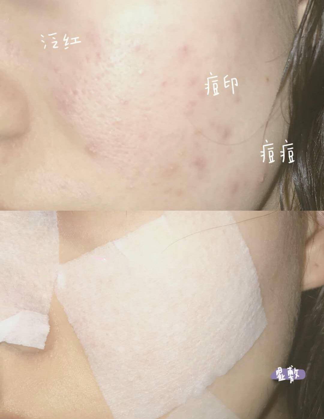 肌肤|别再跟风买了！油皮的【本命水】你喝对了吗？