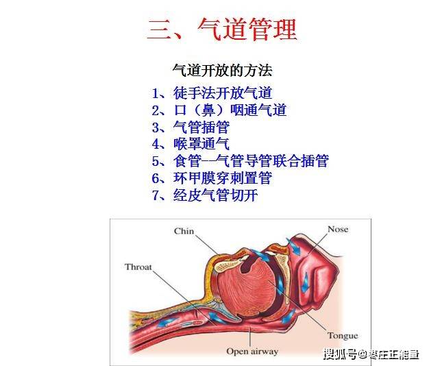 急救心肺复苏AED d4dd31a0057b4810aaa85e6146270e74.jpeg
