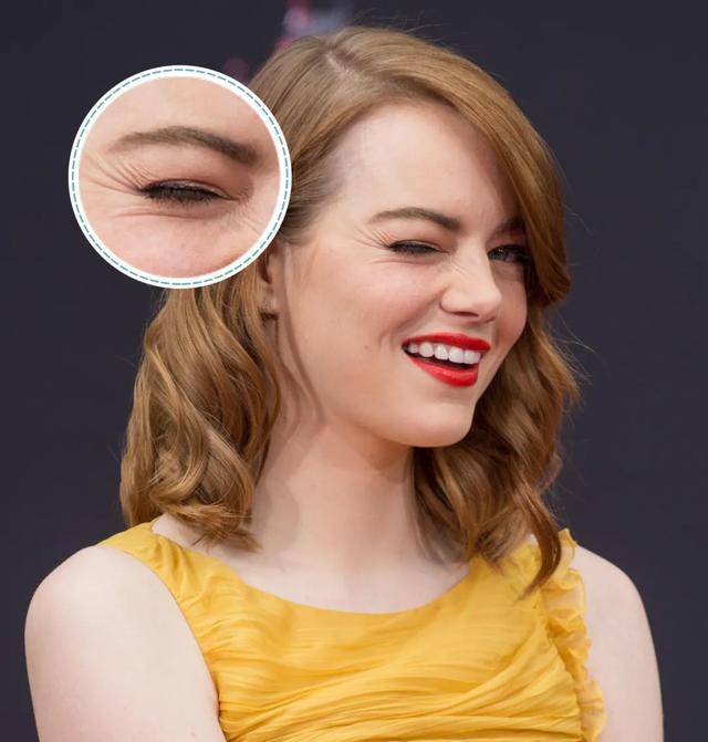 黑眼圈|跑男 6 年，baby 最大的变化是？