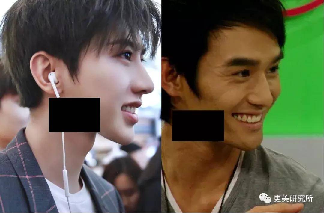 伸缩|蔡徐坤的下巴会自动伸缩？！这是do脸实锤了？