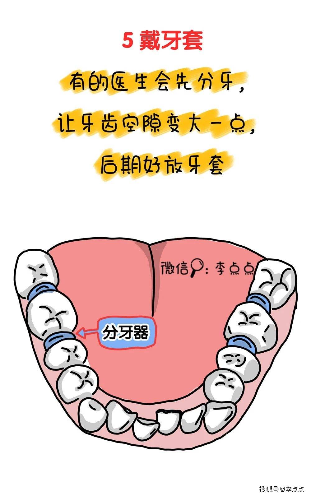 德国|不行！不能让娃长残！我得带他整牙去了