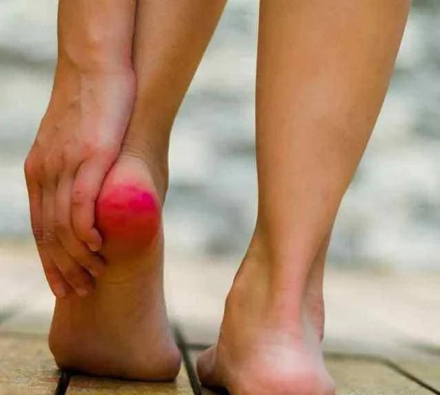 原创糖尿病烂脚发生前,身体有6个信号,早知道早预防 原创糖尿病烂脚发生前,身体有6个信号,早知道早预防