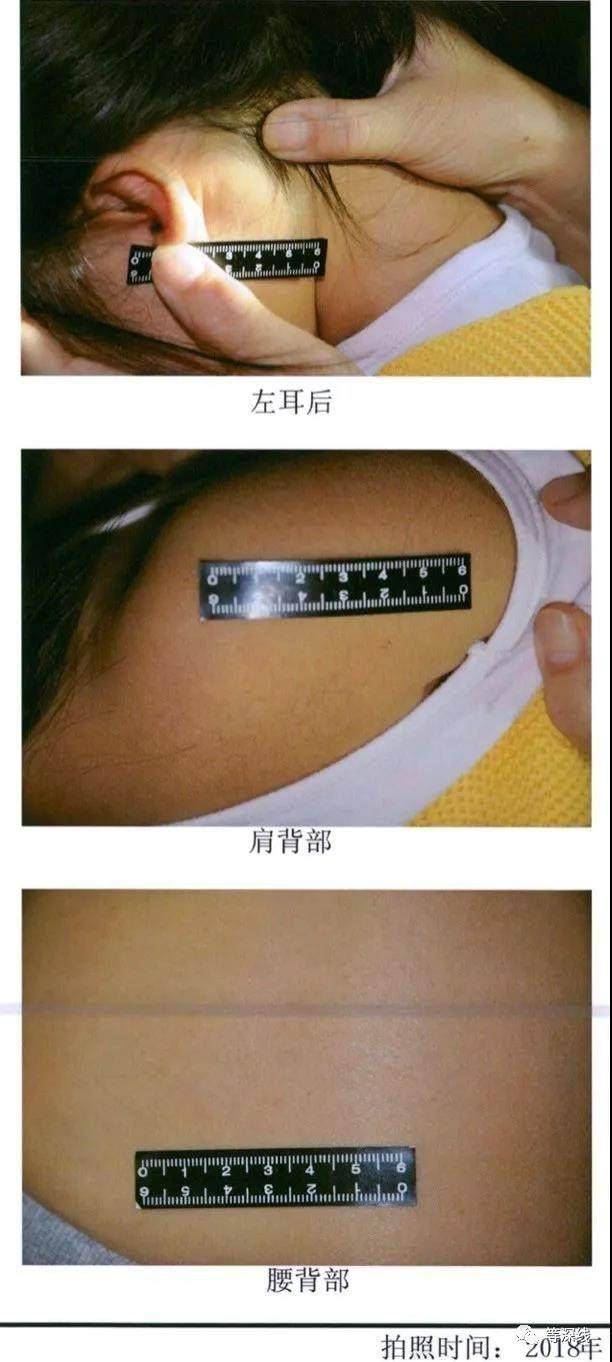 触目惊心!天津“针扎虐童案”一审宣判:3幼教不认罪,法院采信幼儿证言 触目惊心!天津“针扎虐童案”一审宣判:3幼教不认罪,法院采信幼儿证言