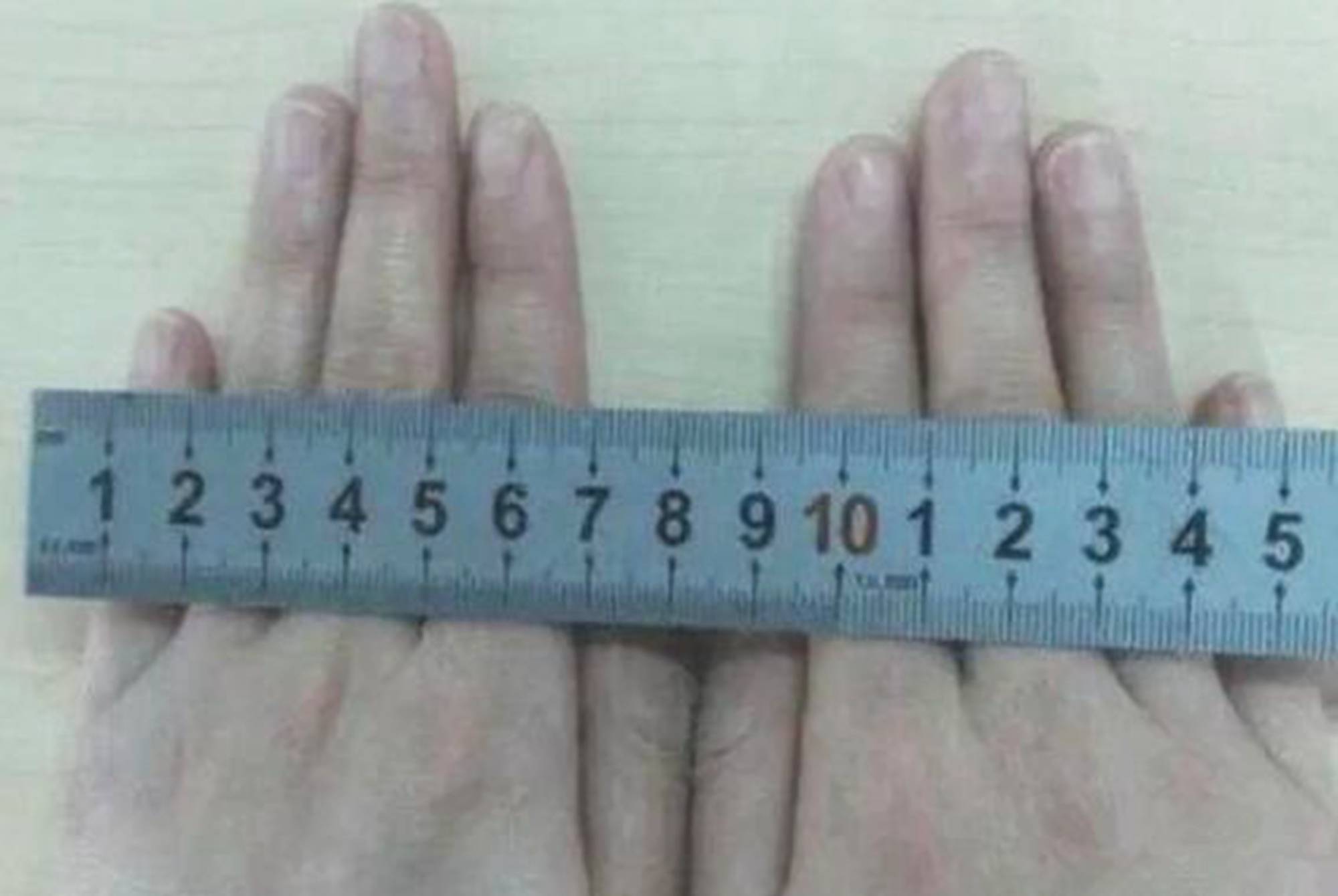 分娩“开十指”有多大？一张图带你了解，开宫口的全过程_阵痛
