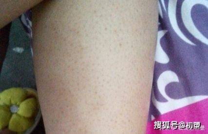 怎么让自己的皮肤变粗糙 18db31c895f444ae84a8dc8562b85442.jpeg