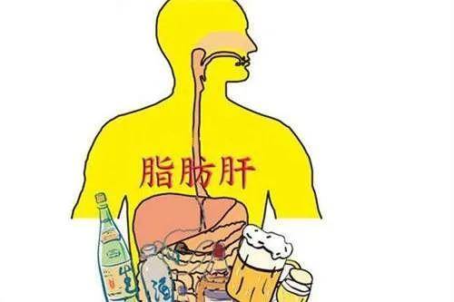 怎样减肥才不会得脂肪肝 5d3378b66d9748e0bfdfef4f131a51cb.jpeg