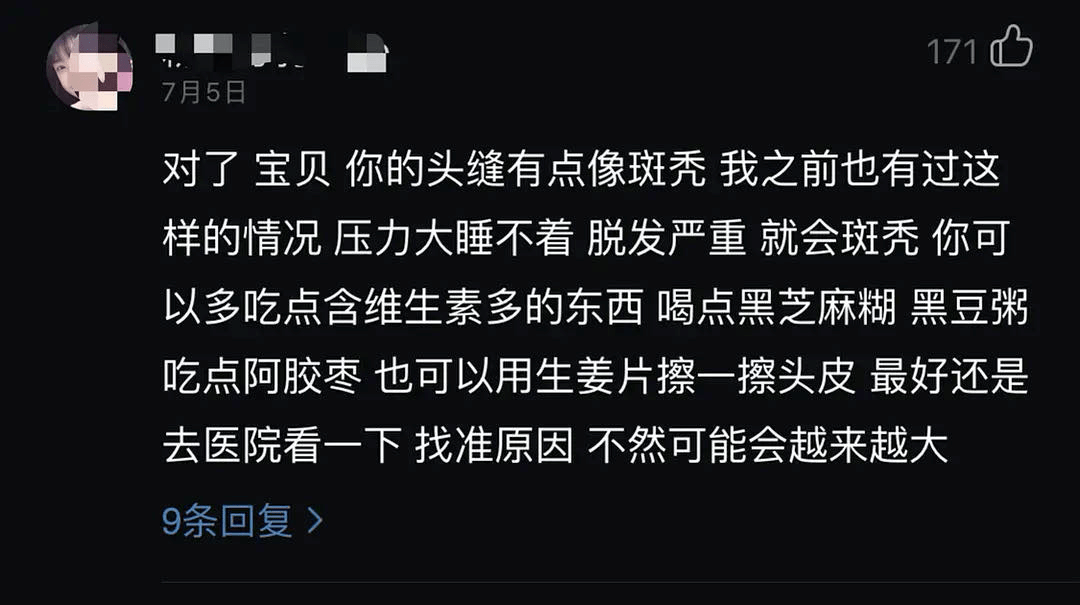 斑秃|赵露思最新生图居然被曝斑秃？发量一骑绝尘也经不住这么造啊...