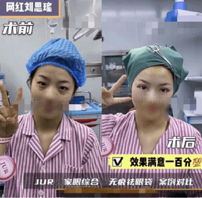 事件|刘思瑶又出黑料!撒野事件后又曝整容,水友:我和她一个医院