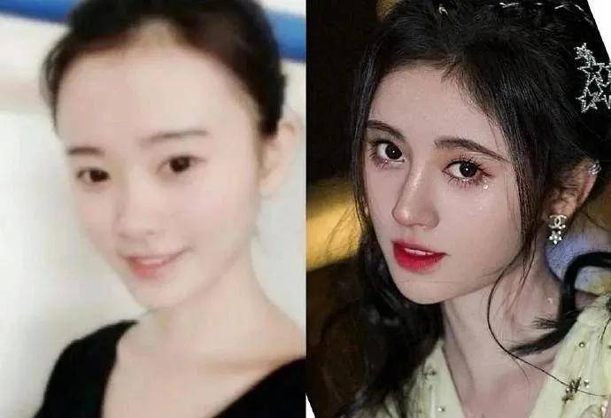 刘海|当毛发都在伪造的鞠婧祎失去刘海，场面瞬间窒息！