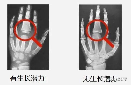 女孩|这件事一定不能忽略3岁女孩被喂到70斤！除了肥胖