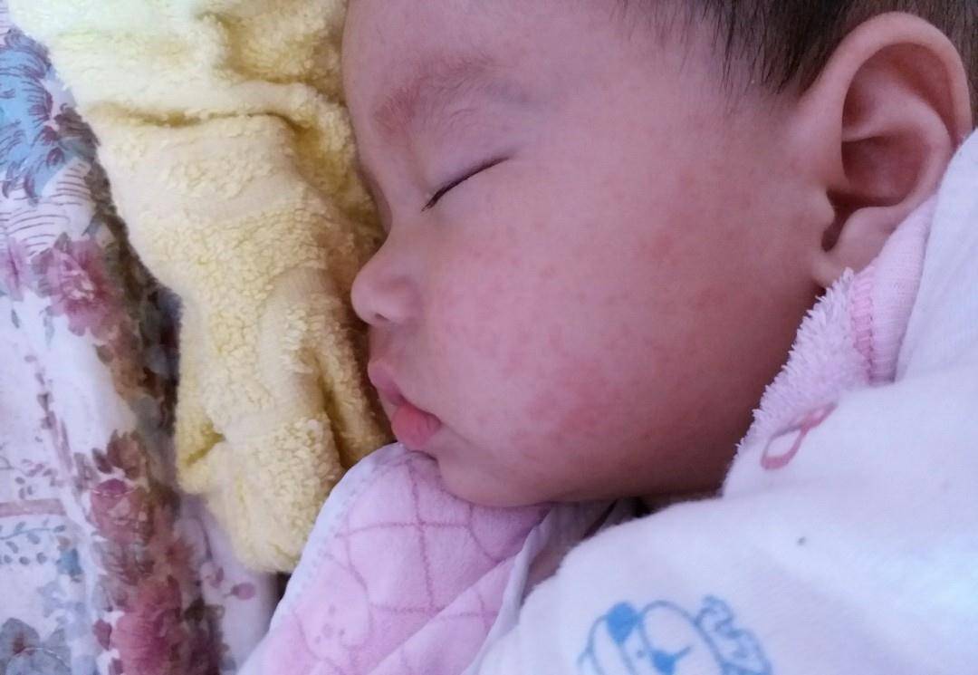 婴儿几个月会发一次烧 3a8adba7633f4e36b40d2b79a6ddafe4.jpeg