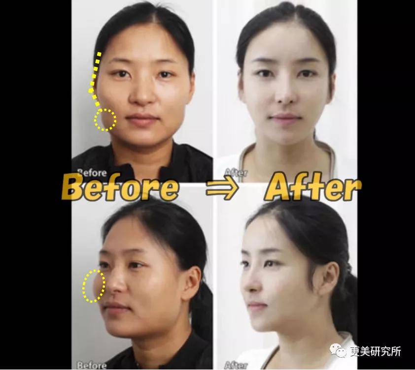 do|20年不崩的do圈C位,鞠婧祎baby都求她医生,堪称医学奇迹