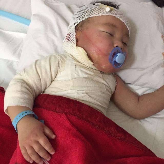 嫌贵|在医院花了1万父母嫌贵， 转而投奔江湖医生后感染身亡男童被烫伤