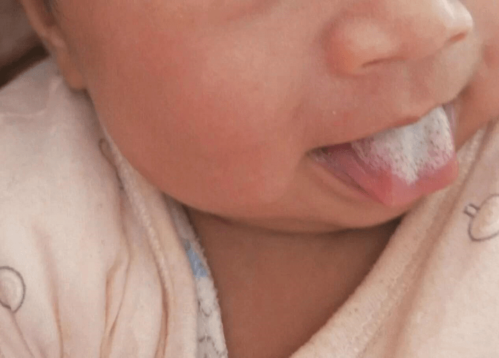 脾胃|“惨虐”孩子的脾胃，食欲差，父母须谨记孩子常吃这三种水果