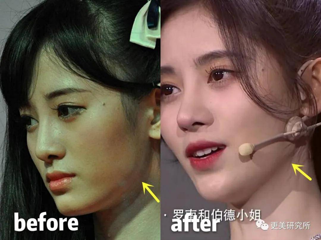 底子|骨相差生逆袭南韩第一时髦精，全智贤都压不住？！