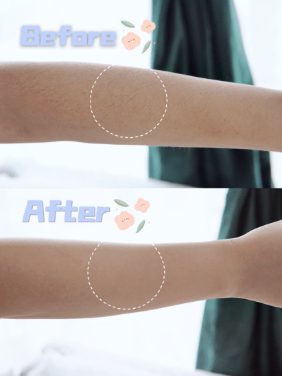 肌肤|veet薇婷脱毛膏,多毛女孩的秘密法宝