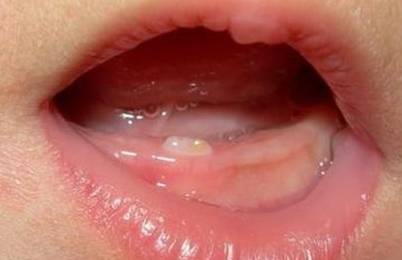 婴儿几个月长上面的牙齿 e37166dc989a4f06bc496807a07ad3c3.jpeg