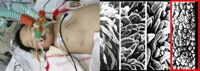 诺如|秋季腹泻高发季来了！这5种宝宝常见病你知道吗？