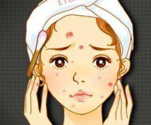 脸上留痘印可以不用激光吗 提醒 这几种痘印真的没必要