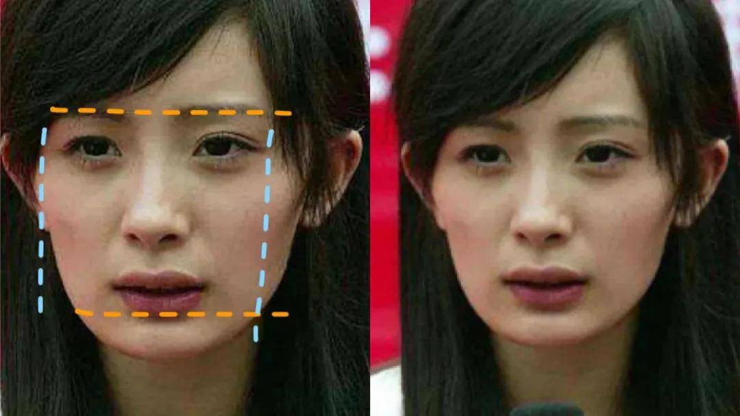 8分|3分到8分，为什么有人是天生适合整容脸?