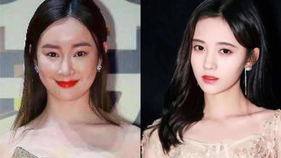 8分|3分到8分，为什么有人是天生适合整容脸?