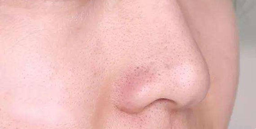 按摩|别整些没用的!谁说长期化妆皮肤就会变差?