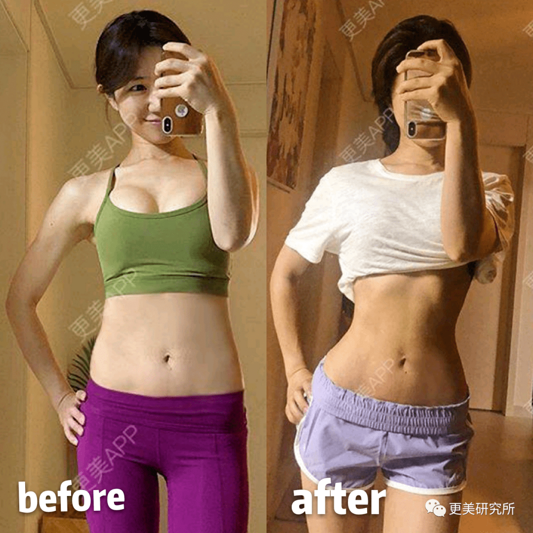 脂肪|鞠婧祎再花70w能do成迪丽热巴的前凸后翘？！