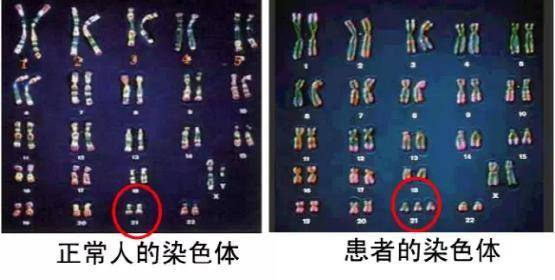 染色体异常的原因