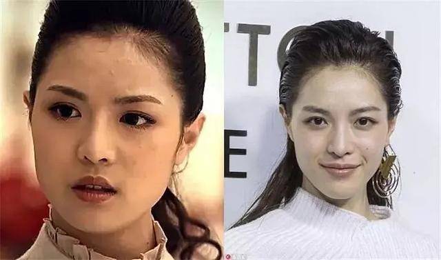 许玮|高圆圆动了这里年轻十岁，一直被当成天然脸的许玮甯做得最成功