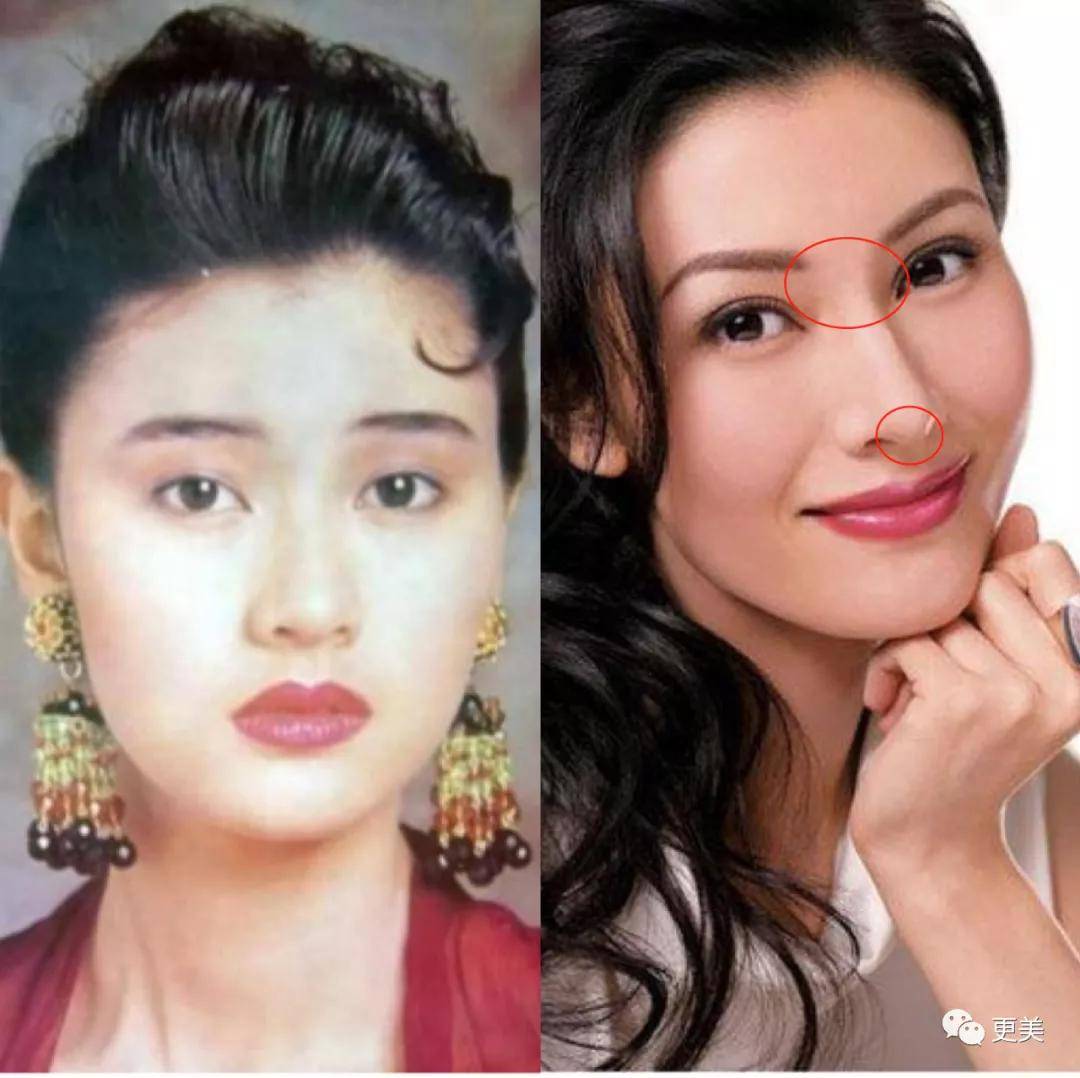 do|胖成球，眼睛do到快掉出眼眶，周杰伦最美“前女友”咋了...