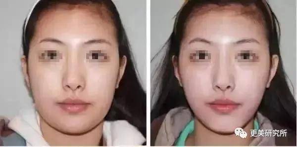 fa|今年最火的三字顶流这是要做鞠婧祎第二，换头动骨do全套？