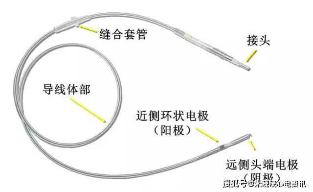 起搏系统由脉冲发生器(即我们平时所称的起搏器),电极,以及人体组织