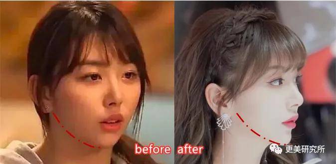 fa|今年最火的三字顶流这是要做鞠婧祎第二，换头动骨do全套？