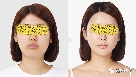 fa|今年最火的三字顶流这是要做鞠婧祎第二，换头动骨do全套？