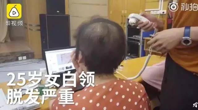 电梯|一根头发25元，我的头发能抵一套房