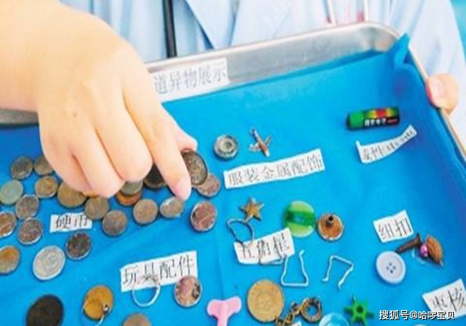 硬币|照顾孩子要细心，有些东西X光也照不出2岁宝宝误吞硬币险伤食管