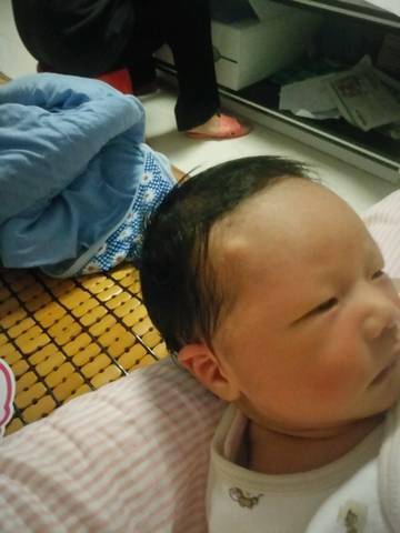 雷区|不然会加重娃的伤情孩子的后脑勺摔伤了咋办？3个雷区不要踩