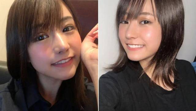 欺凌|长得丑被欺凌，日本妹子花400万成功“换头”，实现人生逆袭！