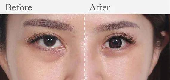 眼袋|从黑皮土妹变成CEO收割机，她到底do了什么？！