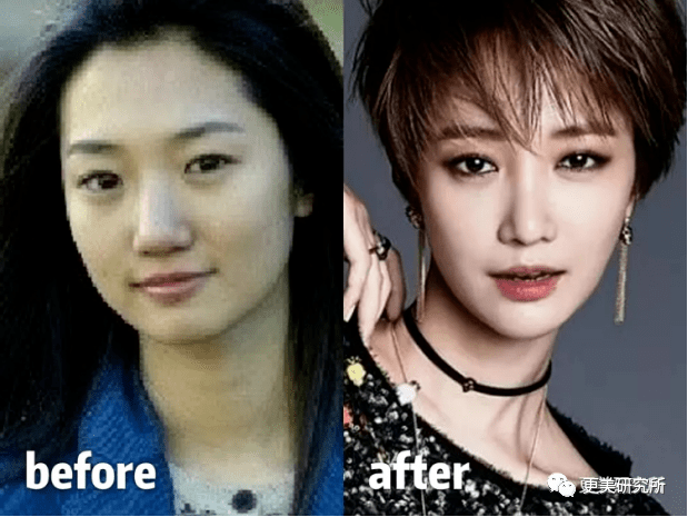 do|贵圈削骨图鉴 | 三代100个女星同时削掉半张脸、杨幂竟还垫底...