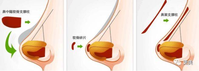杨怡|曾经tvb一姐，演技一流，也把自己整僵了，假体太明显了...