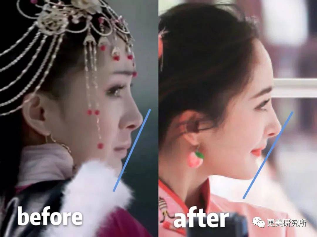 do|贵圈削骨图鉴 | 三代100个女星同时削掉半张脸、杨幂竟还垫底...