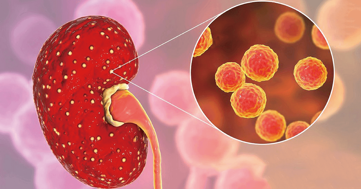 怎么做才会对肾脏好 15ffad543ce244b4a4ed4559f92d3802.png