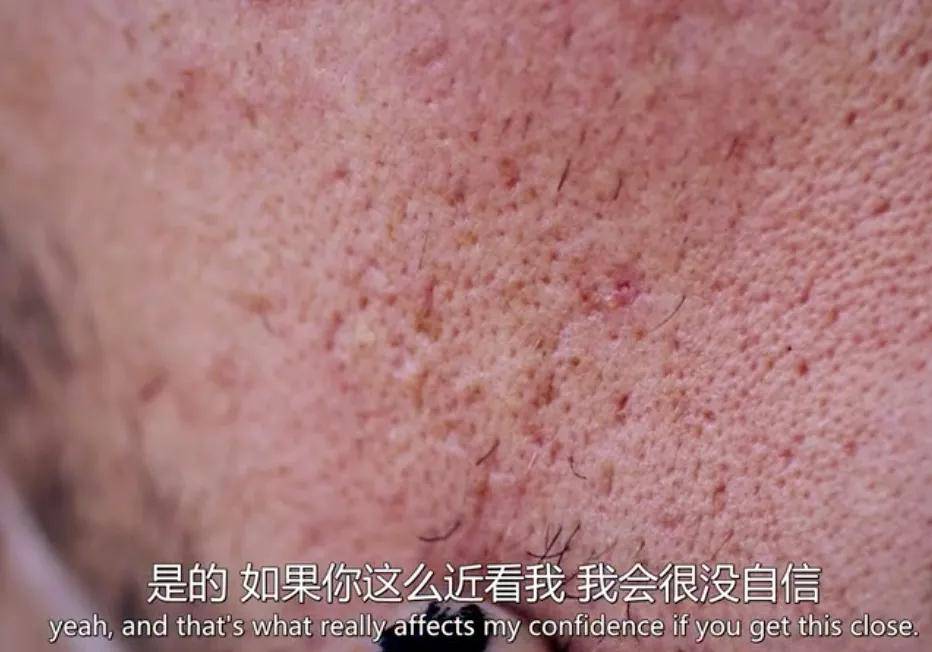 皮肤|16岁就上春晚的顶级流量，现在这脸怎么长残成这样了...