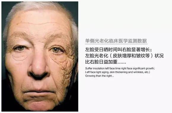 预防光老化,比同龄人年轻_皮肤
