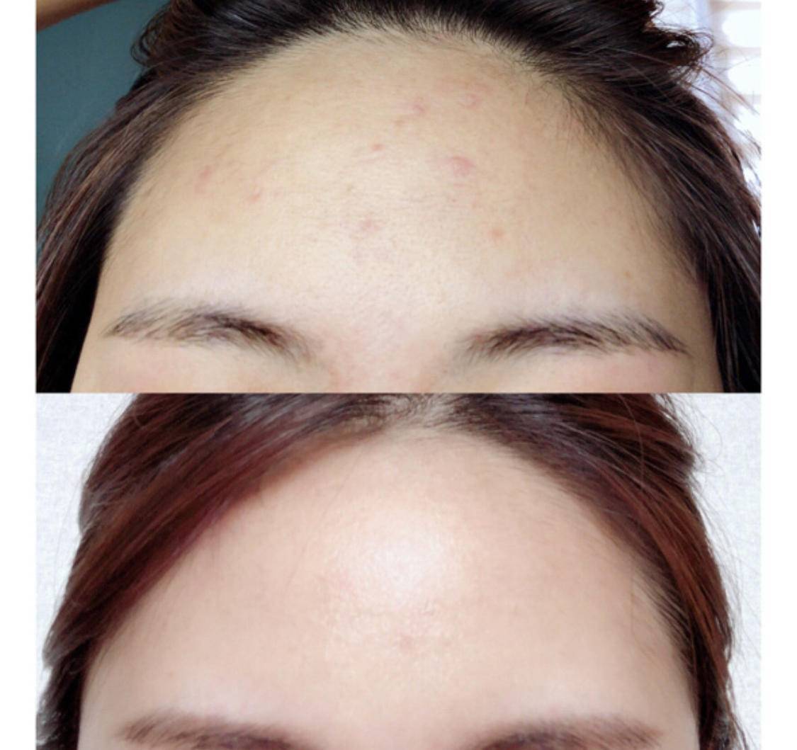 鸡肋|化妆水是鸡肋还是真的有用？用错方法神仙水一样只是瓶水