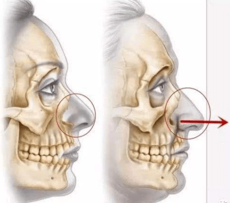 赵丽颖|鞠婧祎和赵丽颖竟然是同一个医生？